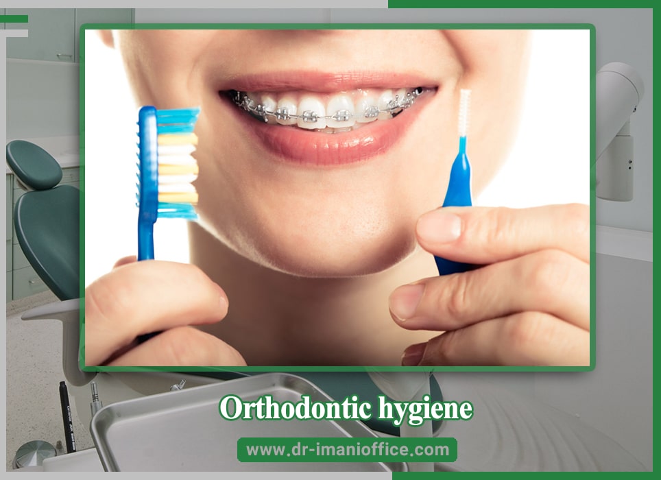 Orthodontic hygiene