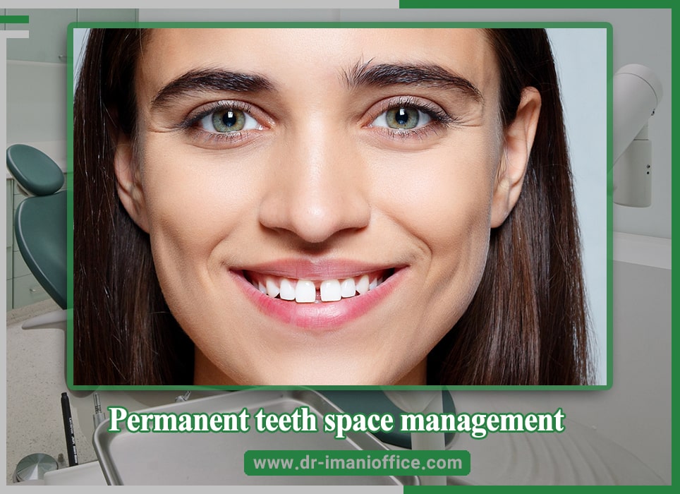 Permanent teeth space management