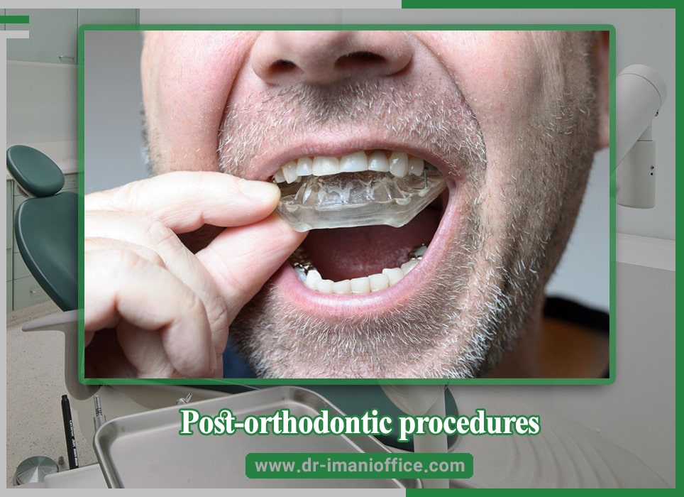 Post-orthodontic procedures