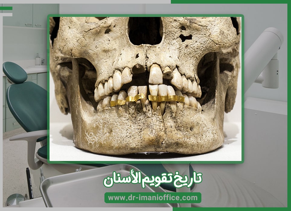 تاريخ تقويم الأسنان